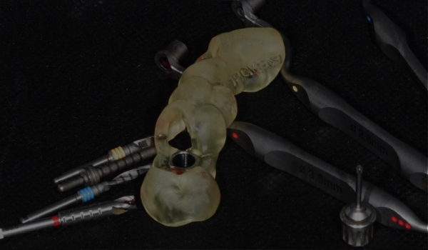 Установка импланта по шаблону