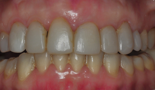 Красивый результат